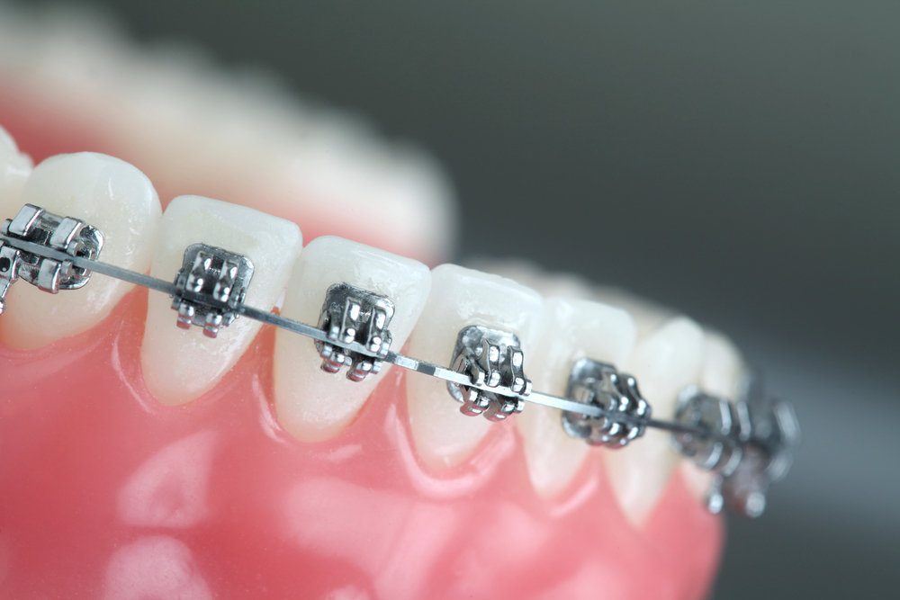 why-orthodontics